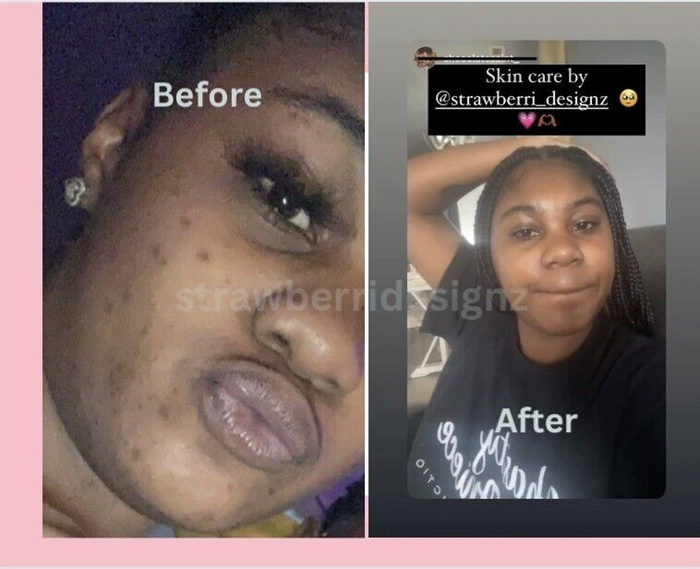 Exfoliating Turmeric Glow Bar Dark Spots , Skin Glow, Brighter Skin, Scars,